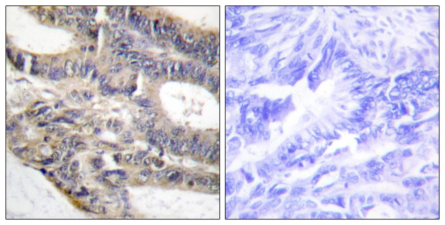RALGAPA2 Antibody
