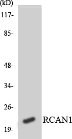 IHC-plus™ RCAN1 / DSCR1 Antibody (aa190-239)