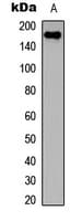 Polyclonal Rabbit anti-Human COL11A2 / Collagen XI Antibody (C-Terminus, WB)