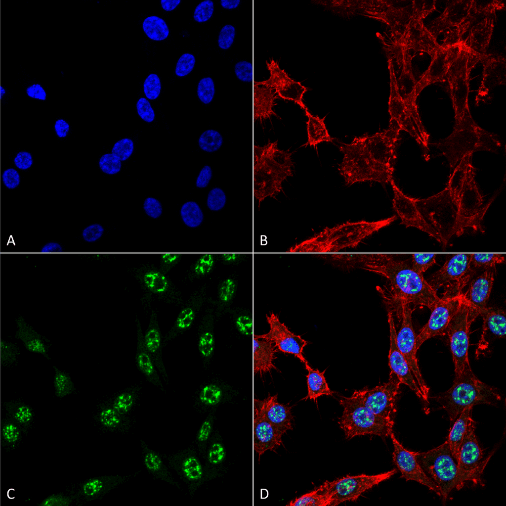 ER Alpha / Estrogen Receptor Antibody