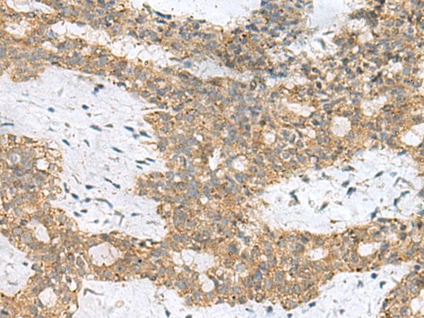 Polyclonal Rabbit anti-Human SKI Antibody (IHC, WB)
