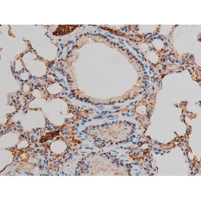 GATA1 Antibody (phospho-Ser142)
