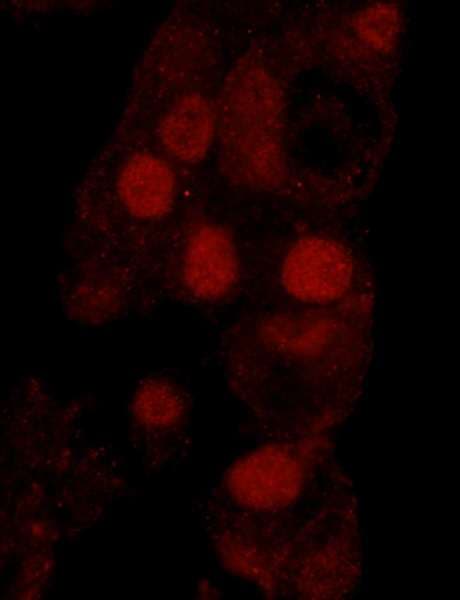 WRNIP1 / WHIP Antibody (aa400-450)