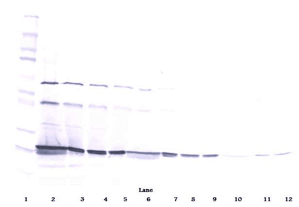 CTF1 / Cardiotrophin-1 Antibody (Biotin)