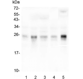 Polyclonal Rabbit anti-Human RHOB Antibody (IHC, WB)