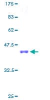 Human SCP2 / SCPX Protein (Recombinant GST)