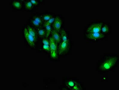 IDH1 / IDH Antibody