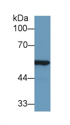ALDH7A1 Antibody (aa29-539)