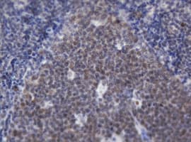 ACD / PTOP Antibody (clone OTI2B1)