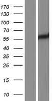 LYN Protein (Over-Expression Lysate Myc-DDK (Flag))