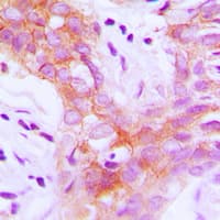 IGF1R / IGF1 Receptor Antibody (phospho-Tyr1161)