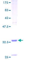 Human MARK4 Protein (Recombinant GST)