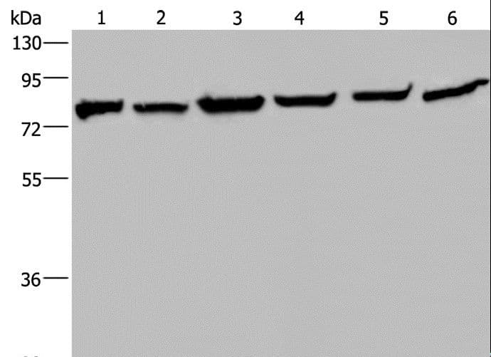 HSPA9 / Mortalin / GRP75 Antibody