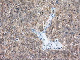ACAT2 Antibody (clone OTI3A11, Carrier-free)