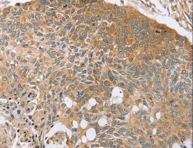 SYTL5 Antibody