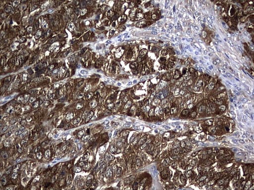 NME1 / NM23 Antibody (clone UMAB92, Carrier-free)