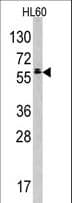TESK2 Antibody (aa210-240)