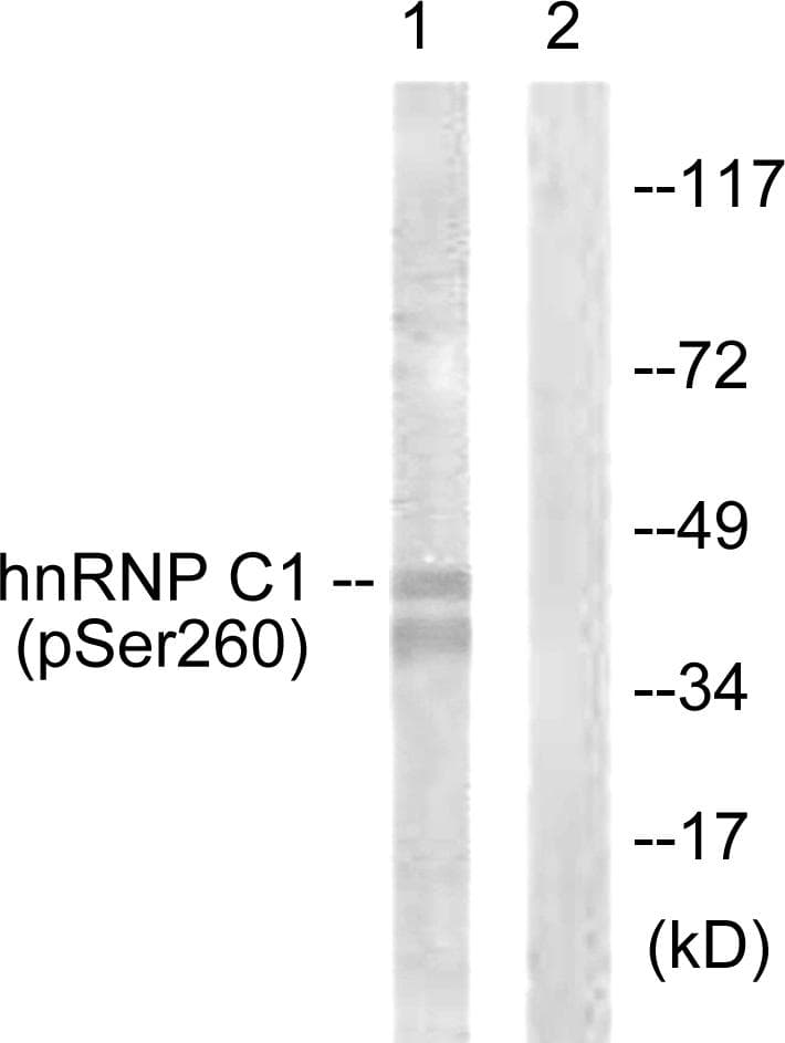 HNRNPC / HNRNP C Antibody (phospho-Ser260)
