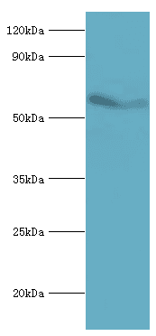 IHC-plus™ ACVR2 / ACVR2A Antibody (aa20-140)