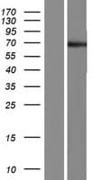 POTEC Protein (Over-Expression Lysate Myc-DDK (Flag))