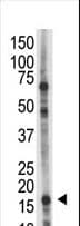 Polyclonal Rabbit anti-Human UBE2L6 Antibody (aa123-153, IHC, WB)