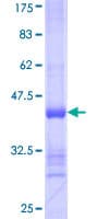 Human RNF217 / IBRDC1 Protein (Recombinant GST, N-terminus)