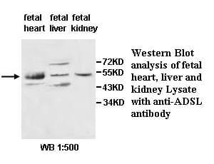 Polyclonal Rabbit anti-Human ADSL / Adenylosuccinate Lyase Antibody (aa202-441, IHC, WB)