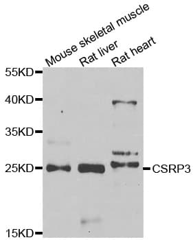 Polyclonal Rabbit anti-Human CSRP3 Antibody (IHC, IF, WB)