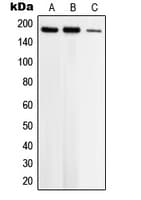 TOP2B / Topoisomerase II Beta Antibody (N-Terminus)