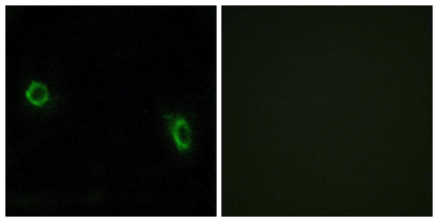 OR6J1 Antibody