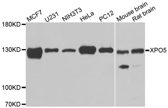 IHC-plus™ Polyclonal Rabbit anti-Human XPO5 / Exportin 5 Antibody (IHC, IF, WB)