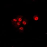 TRIP10 / CIP4 Antibody