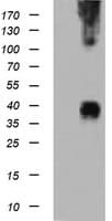 MAP2K3 / MEK3 / MKK3 Antibody (clone OTI3C9)