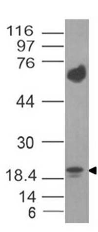 IL17F Antibody