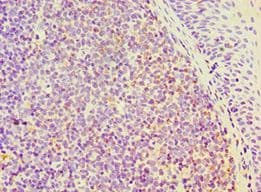 SEMA4C / Semaphorin 4C Antibody (aa749-833)