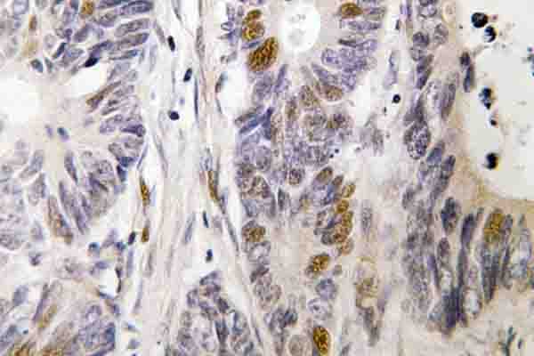 Polyclonal Rabbit anti-Human FOS / c-FOS Antibody (Ser368, IHC, WB)