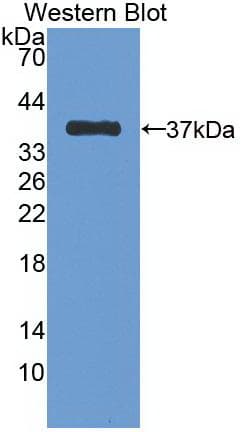 CDH1 / E Cadherin Antibody (aa155-882, Biotin)