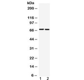 GAA / Alpha-Glucosidase, Acid Antibody