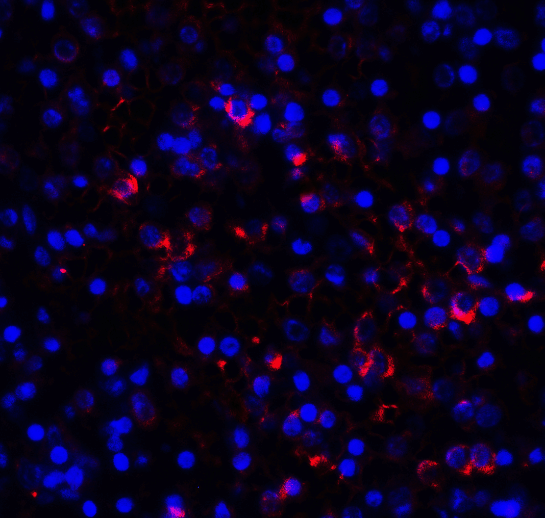 PathPlus™ Monoclonal Mouse anti-Human LAG3 Antibody (clone 9F9, IHC, IF)