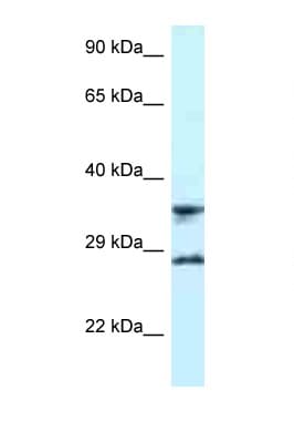 RPS6 / Ribosomal Protein S6 Antibody (C-Terminus)