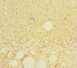Polyclonal Rabbit anti-Human LRRC19 Antibody