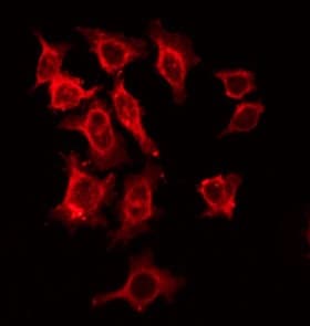 Polyclonal Rabbit anti-Human IL2RB / CD122 Antibody (IHC, IF, WB)