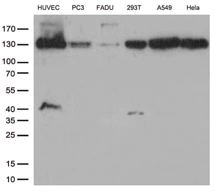 Monoclonal Mouse anti-Human CDH2 / N Cadherin Antibody (clone UMAB23, IHC, IF, WB)