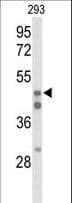 HNF4A / HNF4 Antibody (aa107-139)