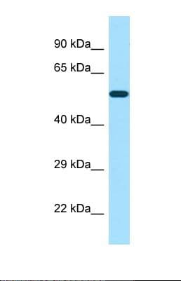 POTEA / POTE8 Antibody (aa247-296)