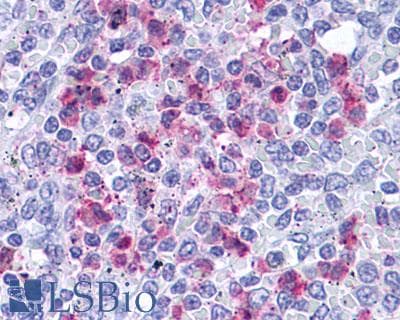 PathPlus™ Leukotriene B4 Receptor / BLT1 Antibody (C-Terminus)