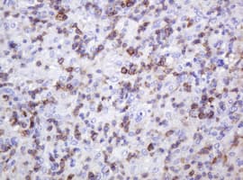 Monoclonal Mouse anti-Human SPN / CD43 Antibody (clone OTI6A4, IHC, WB)