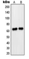 PAX8 Antibody (Internal)