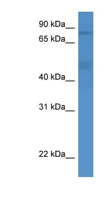 ADD3 Antibody (aa261-310)