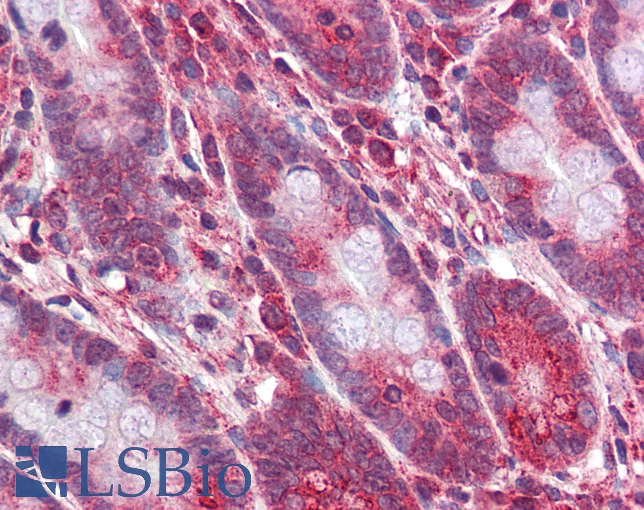 OCA2 / P protein Antibody (aa468-517)